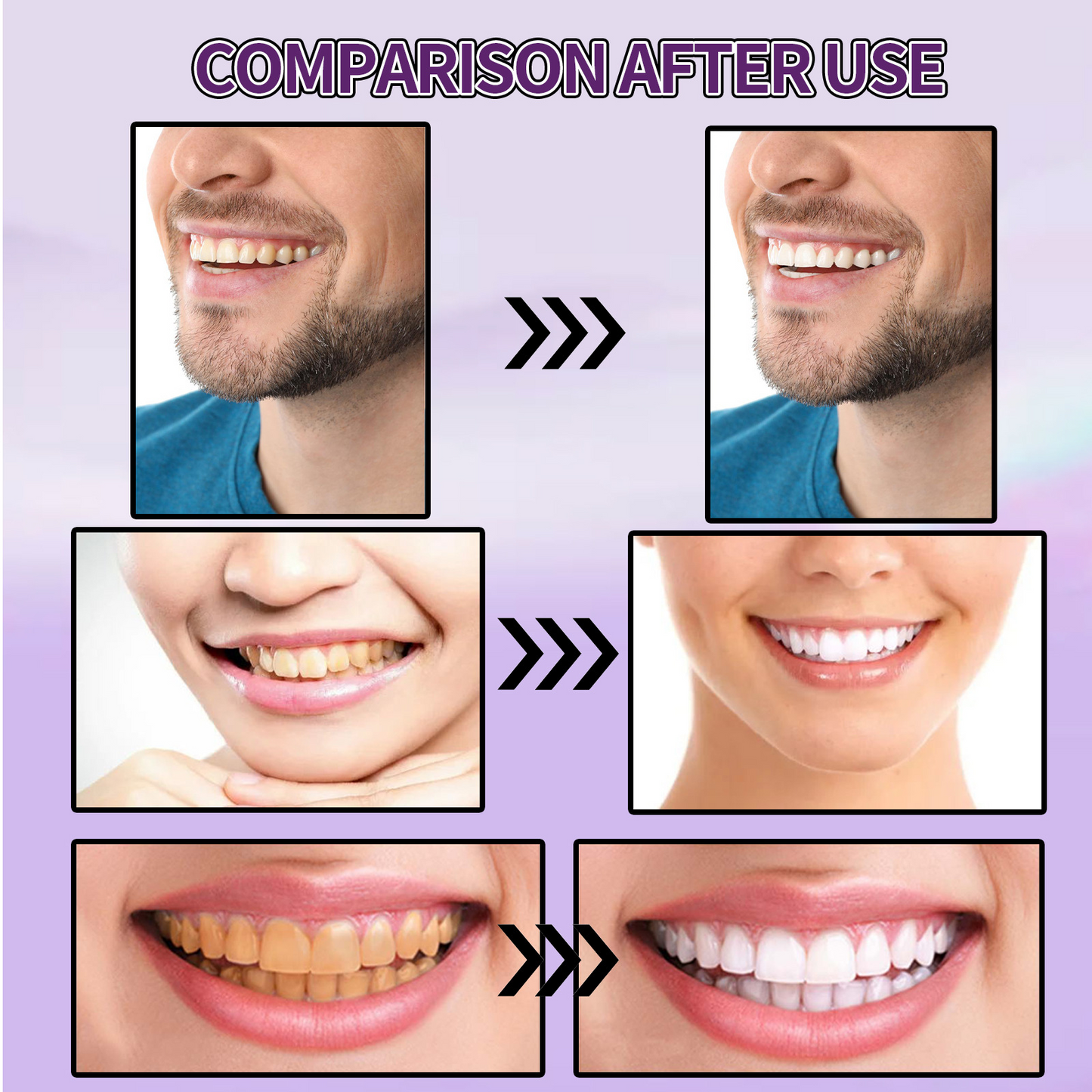 Teeth Colour Corrector Serum