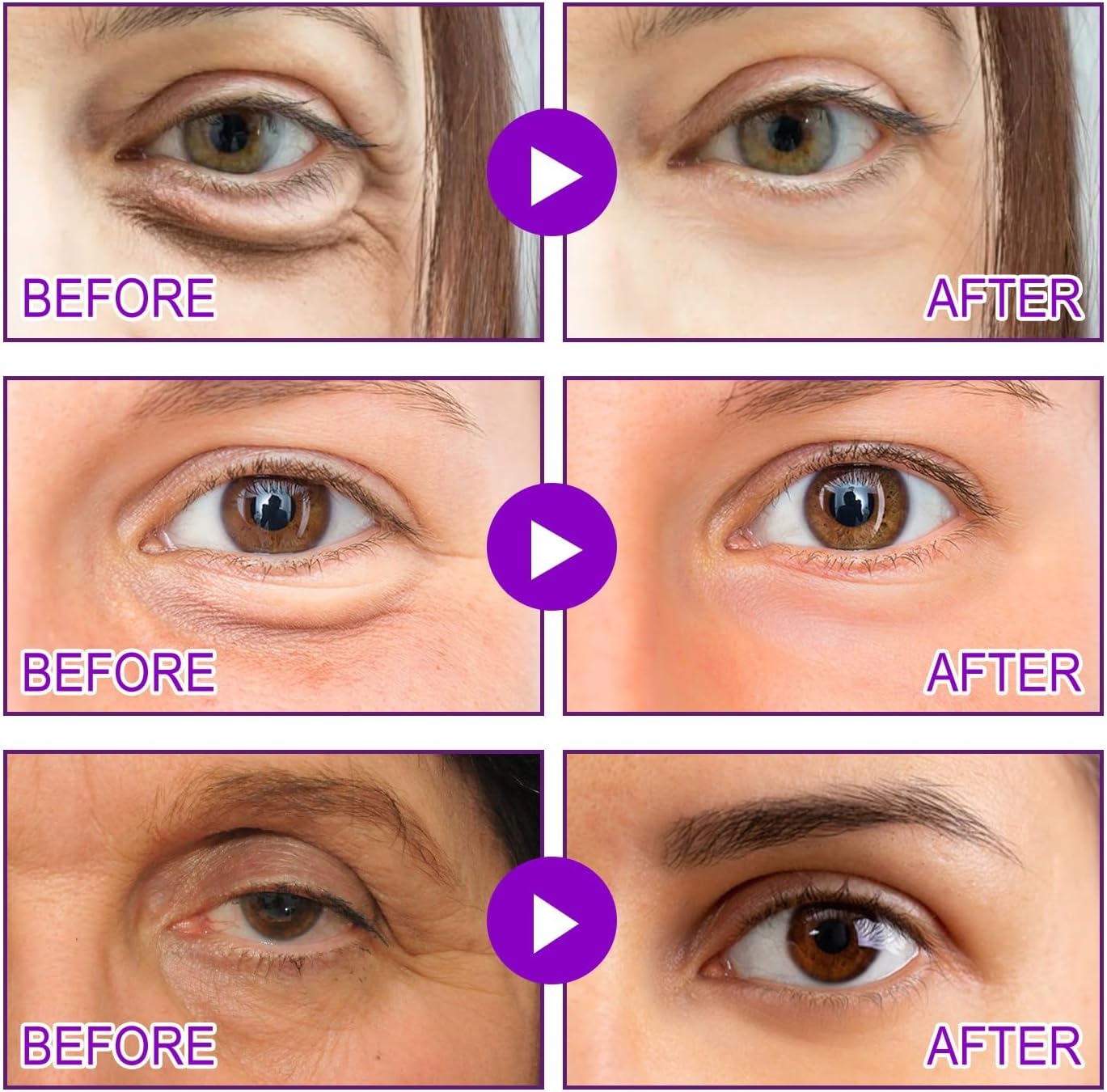 UnderGlow™ – Eye Rejuvenation Patches