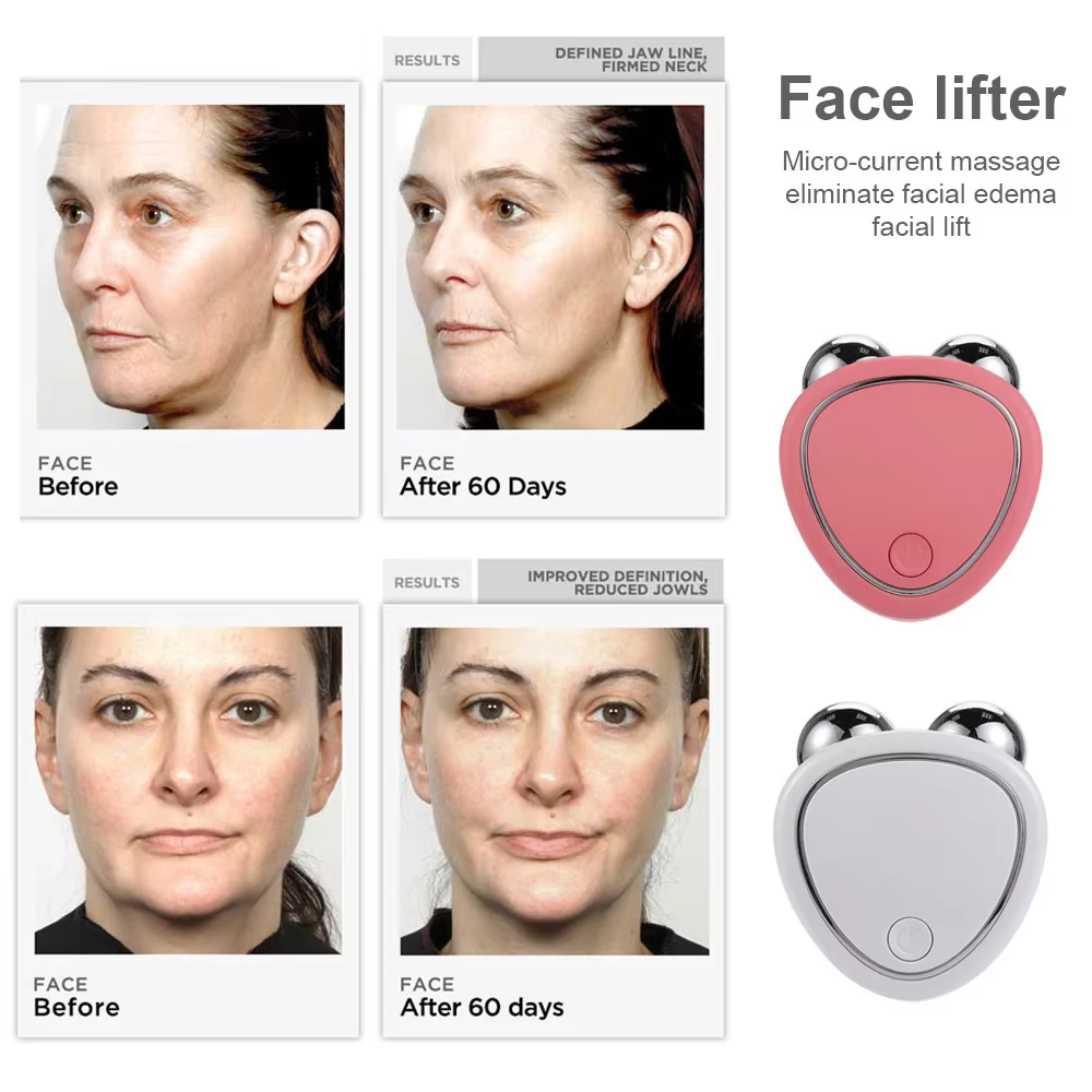 IonSkin - Face Lifting Machine