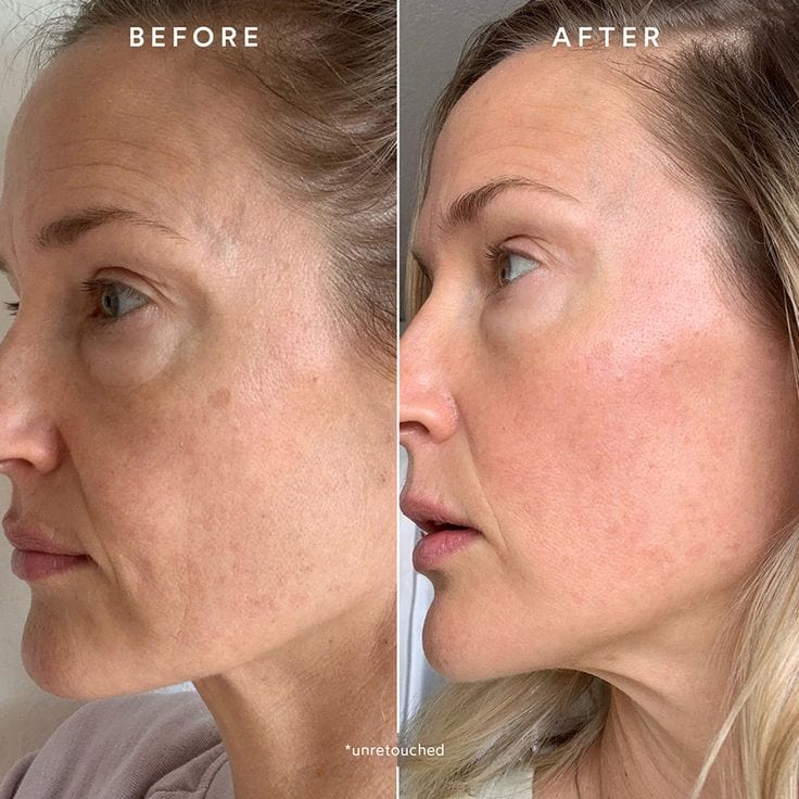 NúevasGlow Deep Collagen Mask