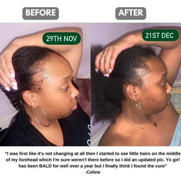 100% Pure Batana Hair Growth Oil