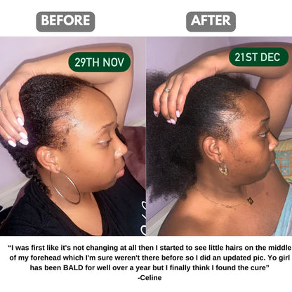 100% Pure Batana Hair Growth Oil