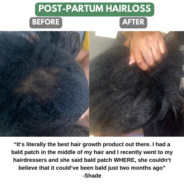 100% Pure Batana Hair Growth Oil
