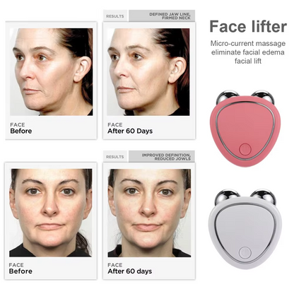 IonSkin - Face Lifting Machine