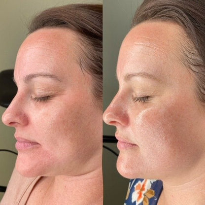 NúevasGlow Deep Collagen Mask