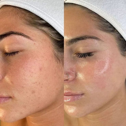 NúevasGlow Deep Collagen Mask